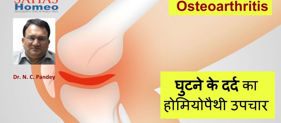 osteoarthritis