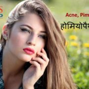homeopathic treatment of pimples wrinkles an acne