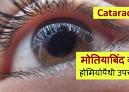 Homeopathic treatment for Cataract