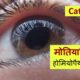 Homeopathic treatment for Cataract