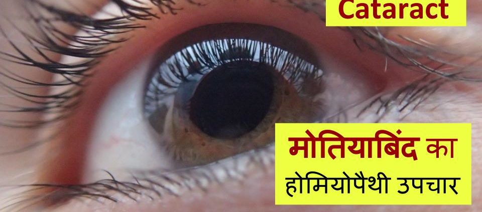 Homeopathic treatment for Cataract