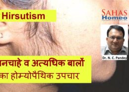 Homeopathic treatment for Hirsutism