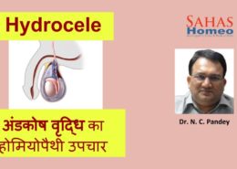 hydrocele_treatment_homeopathy