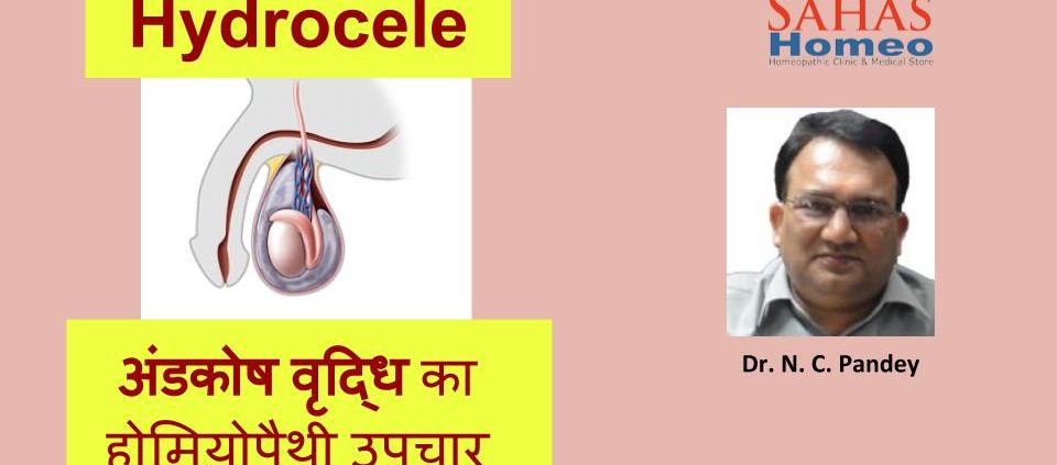 hydrocele_treatment_homeopathy