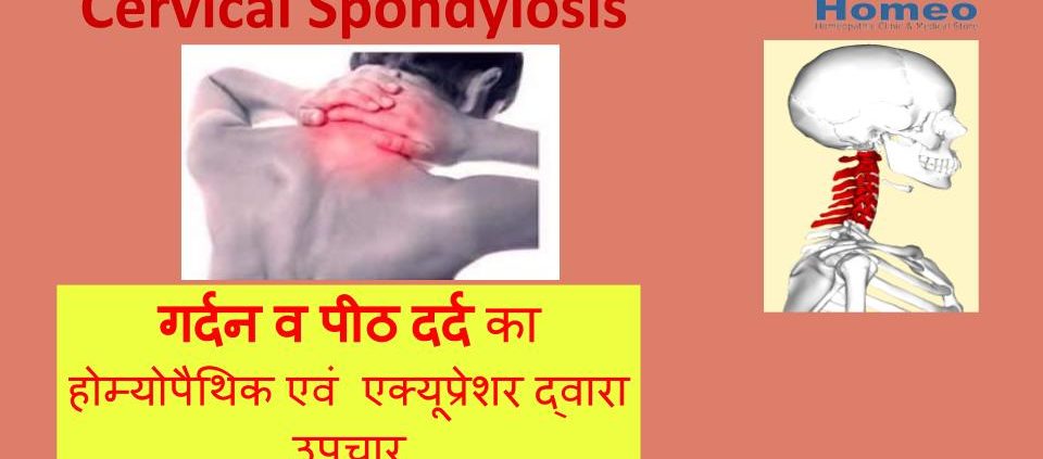 Cervical Spondylosis, गर्दन व पीठ दर्द का होम्योपैथिक एवं एक्यूप्रेशर द्वारा उपचार