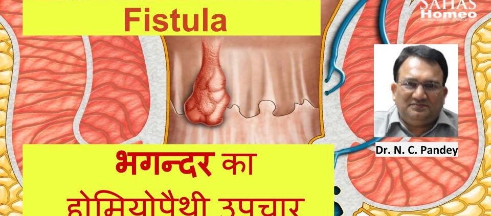 Homeopathic treatment for fistula