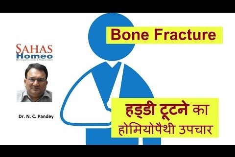 Homeopathic medicine for Bone fracture