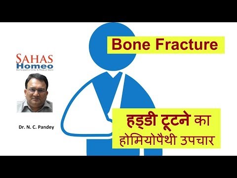 Homeopathic medicine for Bone fracture